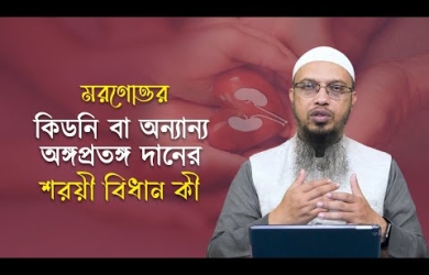 মরণোত্তর কিডনি বা অন্যান্য অঙ্গপ্রতঙ্গ দানের শরয়ী বিধান কী?