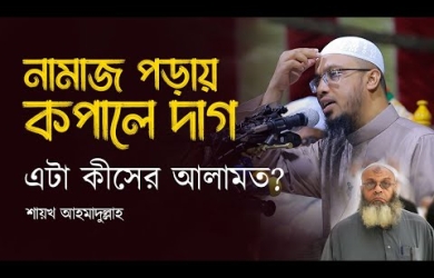 নামাজ পড়তে পড়তে কপালে দাগ--কীসের আলামত?