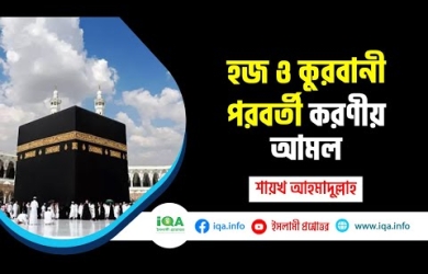 হজ ও কুরবানী পরবর্তী করণীয় আমল